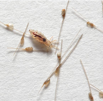 The image shows a close-up view of a head louse (Pediculus humanus capitis) along with several nits (lice eggs) attached to hair strands. The louse appears to be an adult with a translucent, segmented body and visible internal structures. The nits are oval-shaped and firmly attached to individual hair strands.