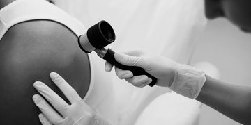 "A black and white photograph of a dermatologist wearing gloves examining a patient's shoulder using a dermatoscope. The patient is wearing a sleeveless top, and the doctor is carefully inspecting the skin.