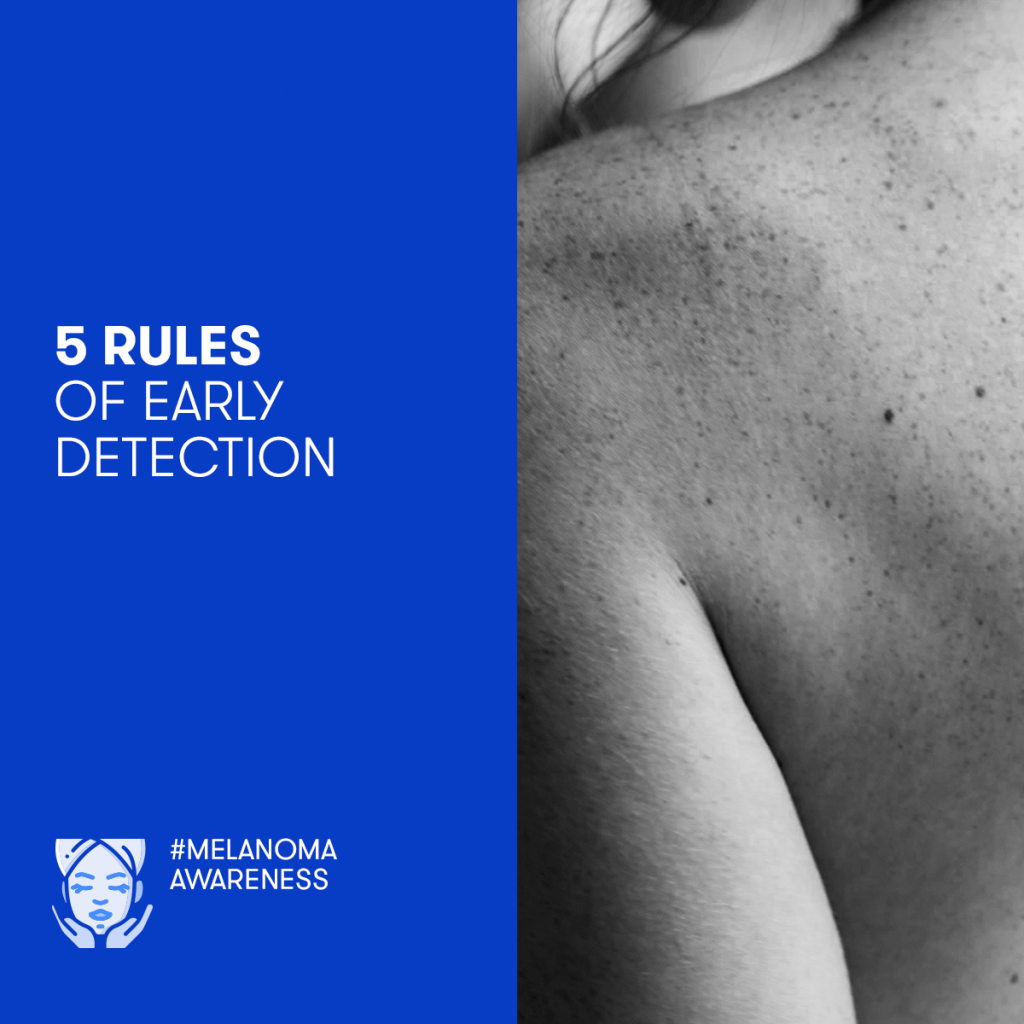 ABCDE checklist to detect melanoma