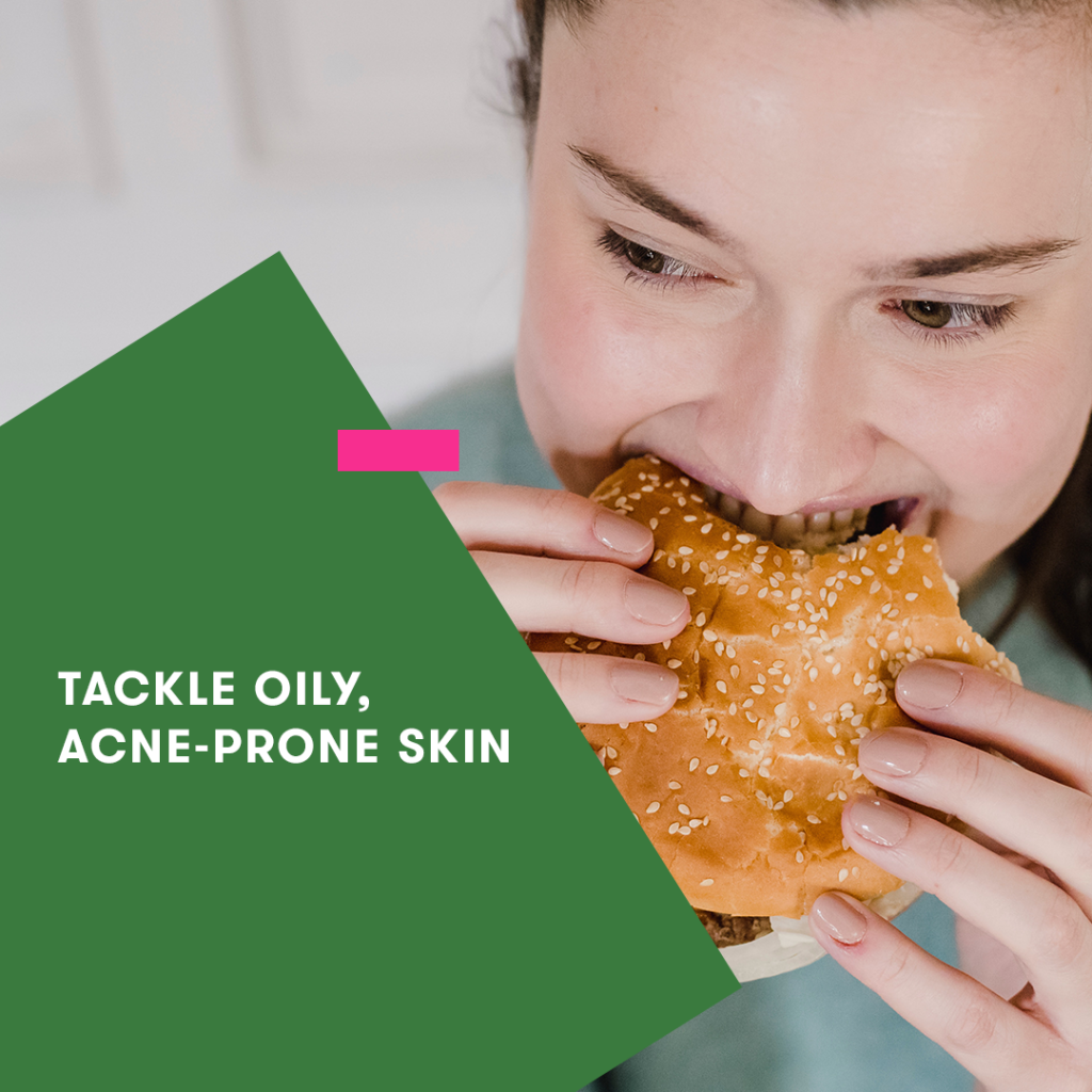 foods that are factors of acne
