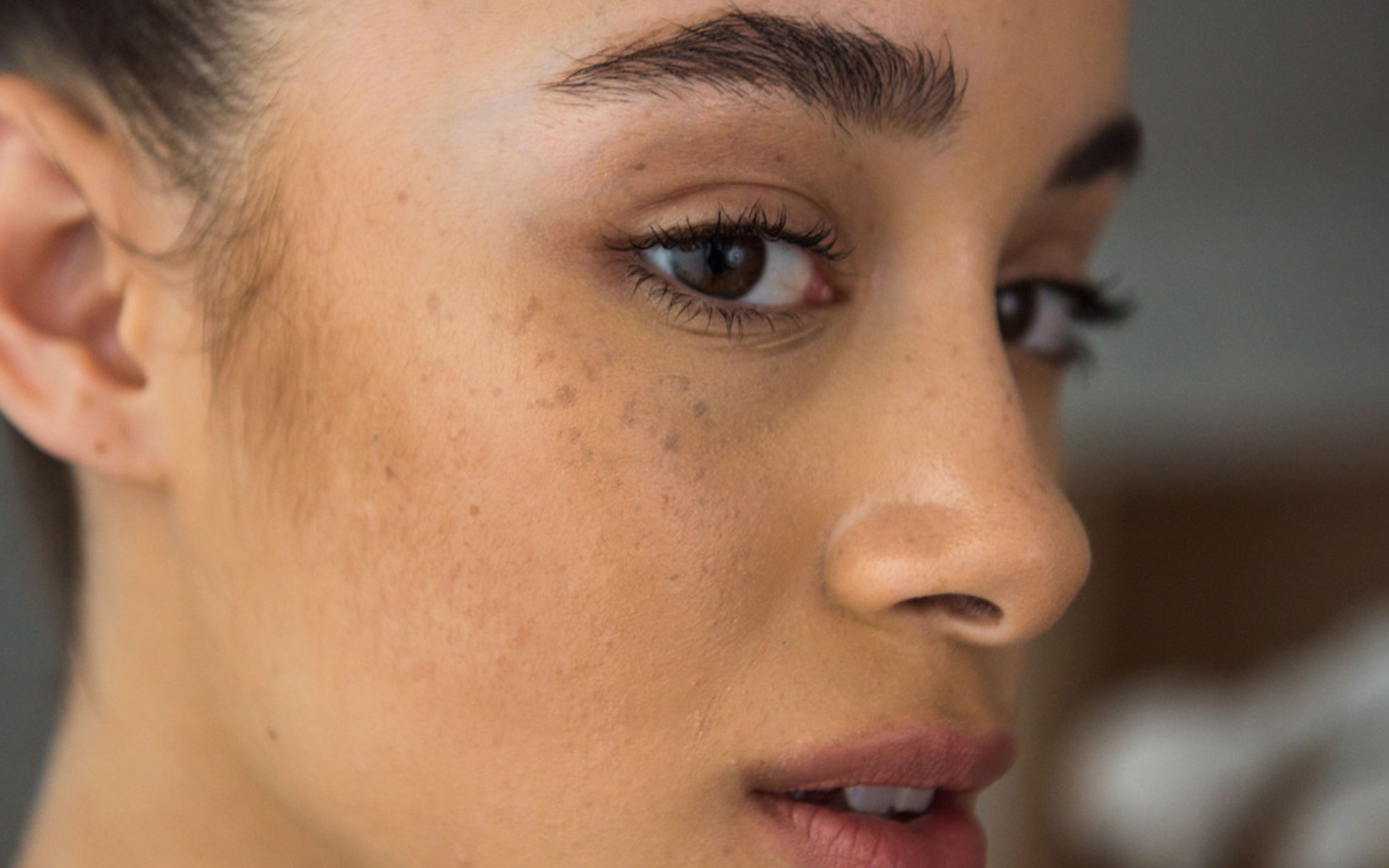 How To Correct Dark Spots And Protect The Face